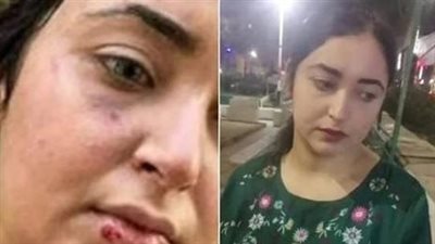 بتهمة الانضمام لجماعة إرهابية.. حبس صيدلانية اتهمت زميلتها بضربها بسبب الحجاب بالشرقية