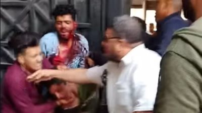 بالعناية المركزة.. تطورات الحالة الصحية لأحمد عوض المصاب بمشاجرة كلية الحقوق بالإسكندرية