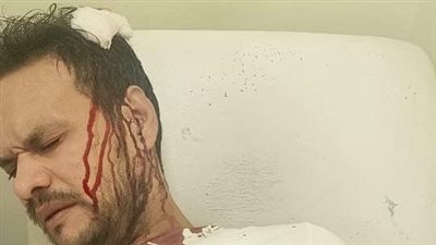 ضبط مرتكبي واقعة اعتداء سائقي توك توك على شاب في أبو صوير بالإسماعيلية