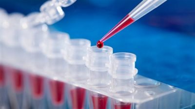 ننشر عناوين المعامل المركزية لتحليل pcr السفر للسعودية 