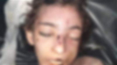 14 يومًا دون طعام.. تفاصيل مقتل طفلة على يد خالتها بفيصل |فيديو 