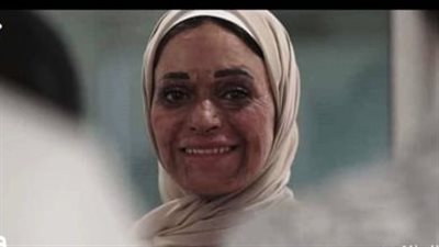  هبة السويدي عن التنمر ببطلة إعلان علاج الحروق: لن تفرط في حقها