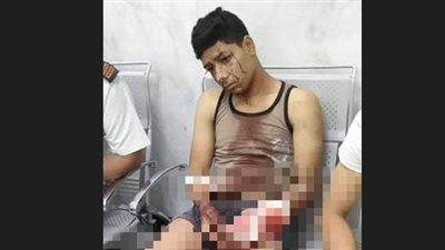 قطعوا كفه ولطخوا المقابر بدمائه.. تفاصيل اعتداء سيدتين و6 أشخاص على شاب بالتبين 
