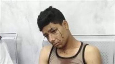  قطعوا كف يده.. ننشر تفاصيل واقعة اعتداء 8 أشخاص على شاب داخل مقابر التبين