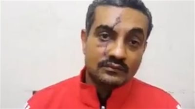 صاحب مطعم يستغيث من تعدي جيرانه عليه بالمنيا: ضربوني بالمطواة وأخدت 144 غرزة | بث مباشر