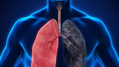 txt