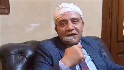 محامي الدقهلية ضحية الاعتداء على يد زميله: جاب بلطجية وضربوني عشان دافعت عن طليقة أخوه | بث مباشر