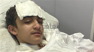 بتر قدم طالب صدمه شاب بـ موتوسكيل في حادث بمدينة نصر | صور 